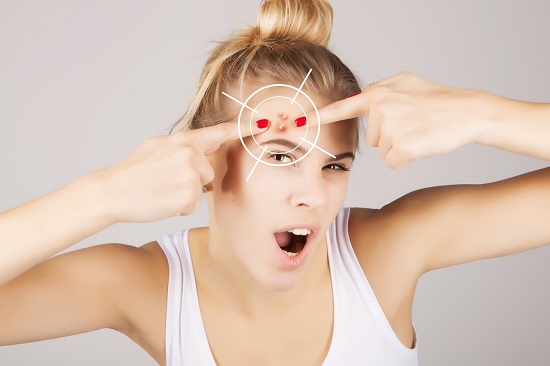 祛痘路上总踩坑，你经历过哪些？怎么正确祛痘