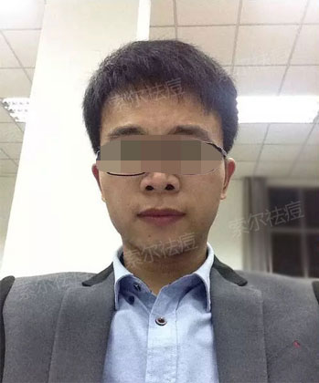 亲测有效 战痘多年的经验之谈
