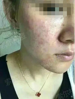 突然变丑是一种怎样的感觉?