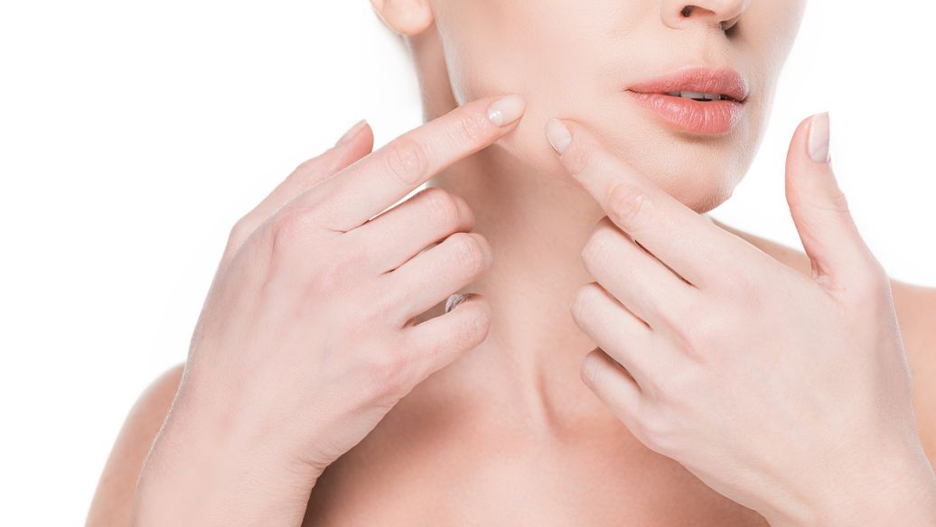 果酸祛痘效果如何? 果酸祛痘适合轻度痘痘