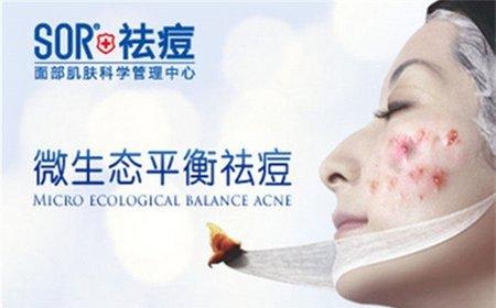 祛痘最好的方法之目前最有效的小妙招及祛痘产品