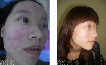 痘友致谢SOR 送来锦旗!