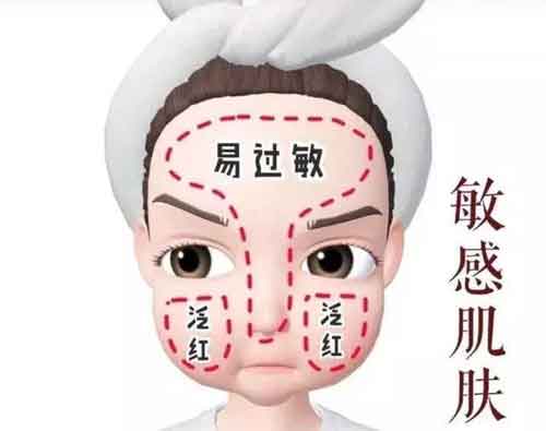 不同肤质如何护肤才正确