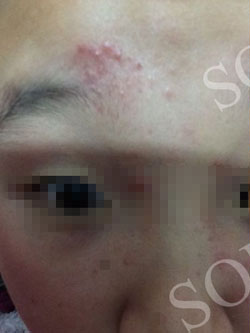 盐洗脸的好处与坏处