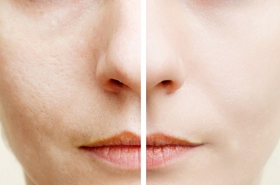 毛孔堵塞的原因有哪些？毛孔粗大怎么办？